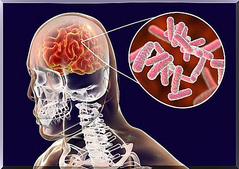 Brain infections, classification and symptoms