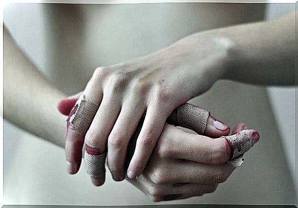 Wounded hands